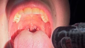 Gardło oświetlane Mactronic Sunscan 5.1