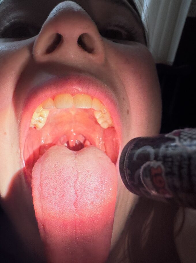 Gardło oświetlane Mactronic Sunscan 5.1